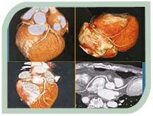 Doctor's Guide to the 64 Slice CT Angio